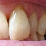 teeth-1347890886.jpg